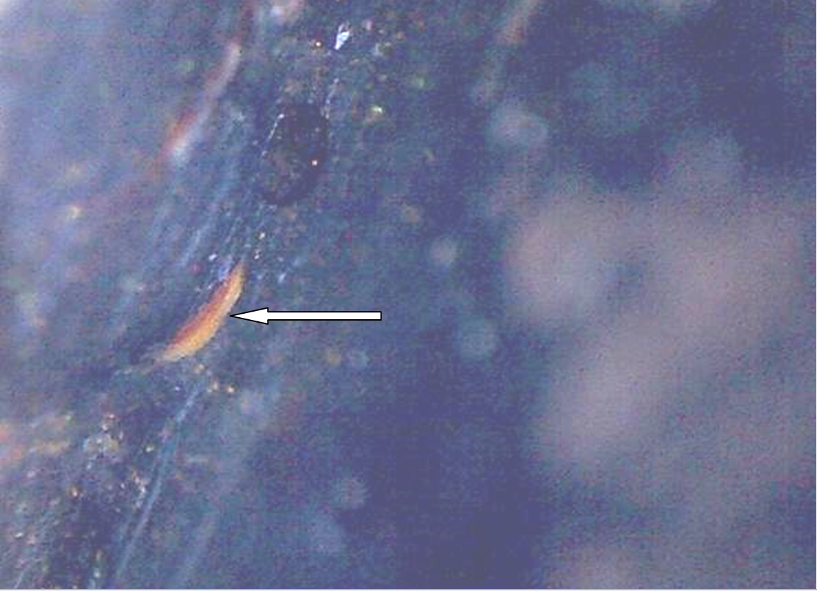 Эксплуатационные дефекты ЛКП кузова