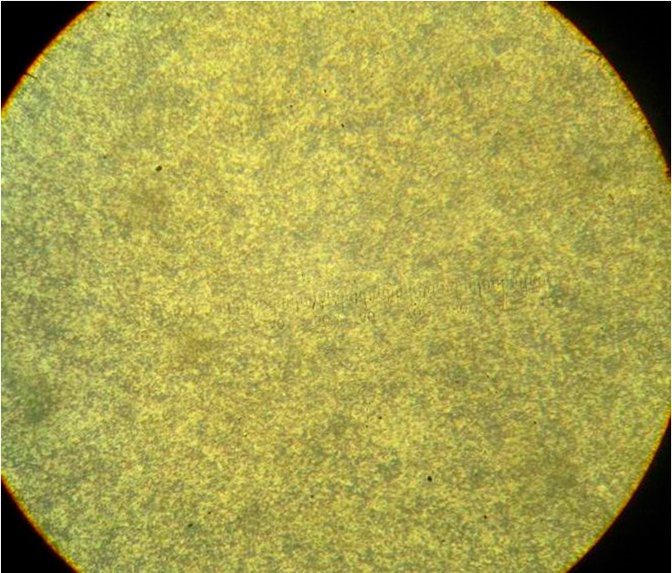 Повреждение подвески от ДТП