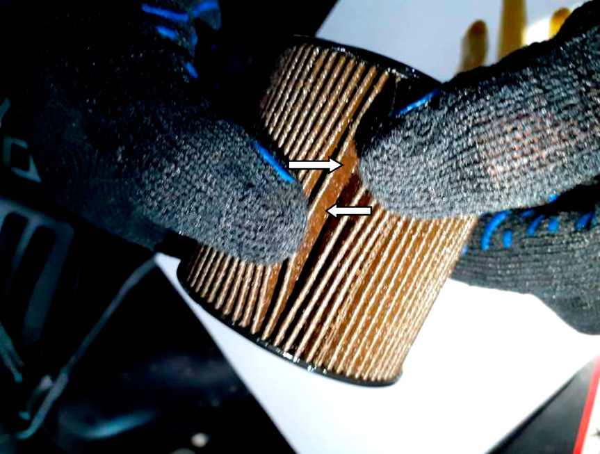 Фото 7. В фильтрующем элементе масляного фильтра зафиксированы фрагменты и частицы металлического вещества.