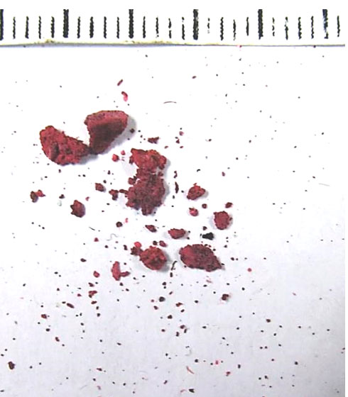 Фото 3. Общий вид вещества, отобранного из ГБЦ двигателя