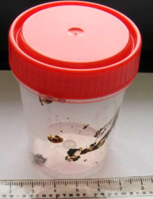 Фото 5. Внешний вид контейнера с соскобом