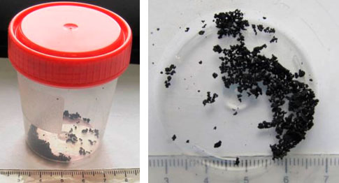 Фото 6,7. Внешний вид контейнера с соскобом нагара с поршней