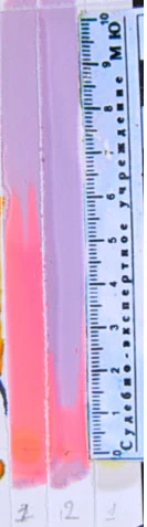 Фото 10. Тонкослойная хроматограмма после обработки раствором 0,05 % дитизона в хлороформе. Система октан – бензол (5:1). 