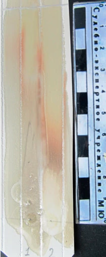 Фото 7. Хроматографическая картина выявленная реактивом ФСК. 