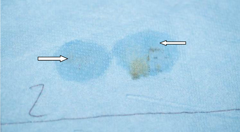 Гидроудар в двигателе