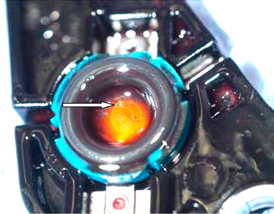 Причина неисправности АКПП