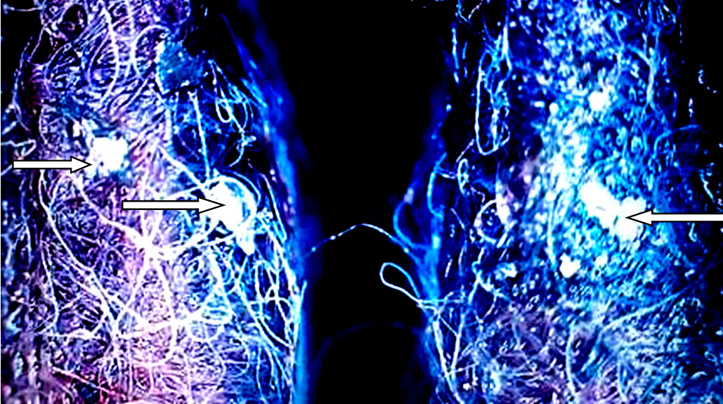 Причина неисправности АКПП